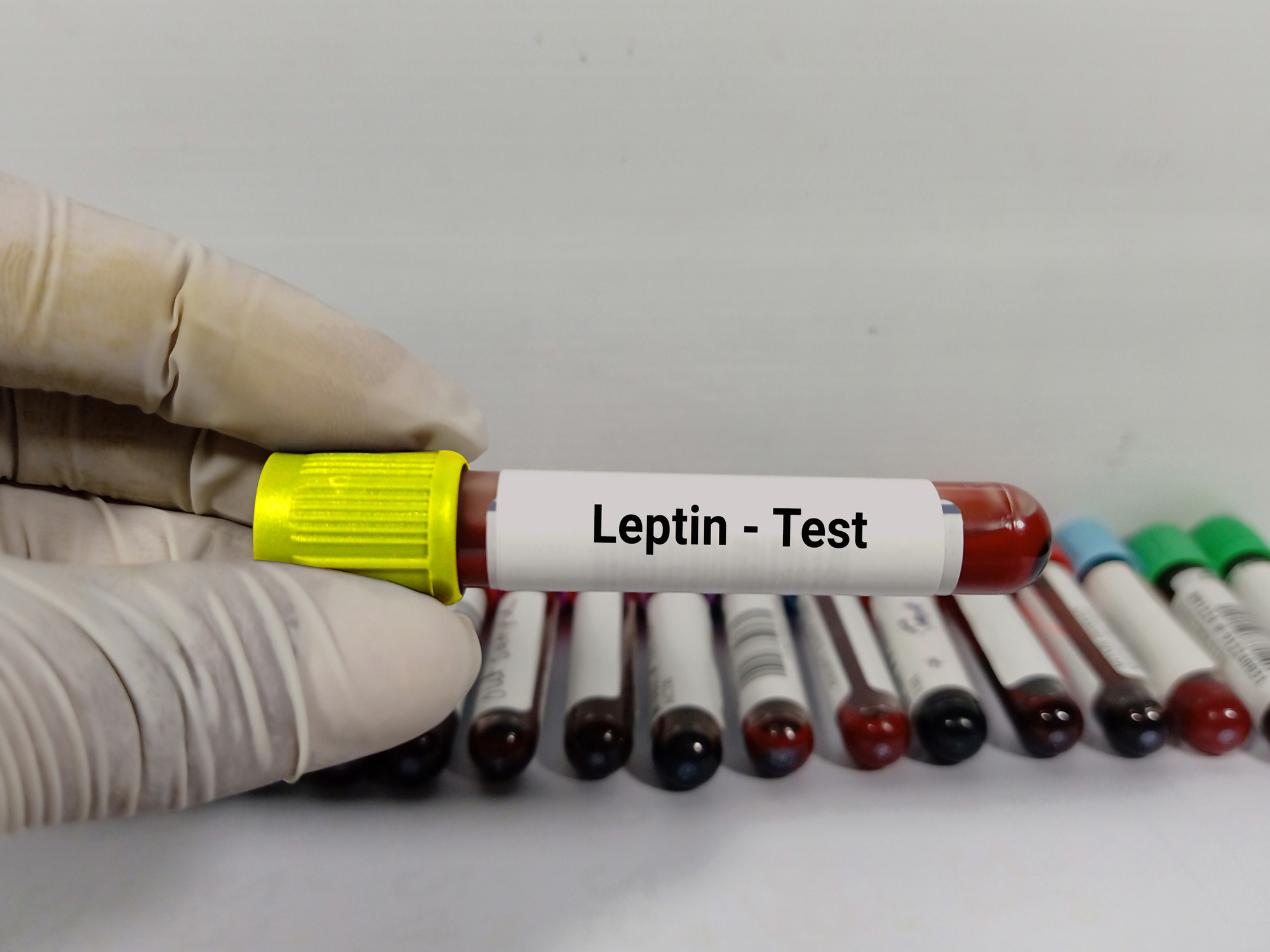 Scientist hold blood sample test tube for Leptin test with laboratory background. Healthcare and medical test concept.